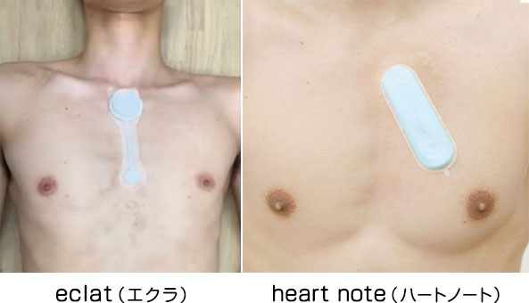 長時間ホルター(7日間)検査の様子